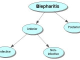 Blepharitis Concept Map