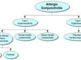 Allergic Conjunctivitis Concept Map