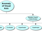 Anomalies of Visual Axis Concept Map