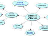 Diseases of Cornea Concept Map