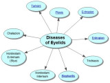 Diseases of the Eyelids Concept Map