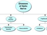 Diseases of Optic Nerve Concept Map