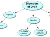 Disorders of Orbit Concept Map