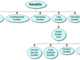 Keratitis Concept Map