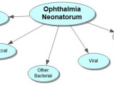 Ophthalmia Neonatorum Concept Map