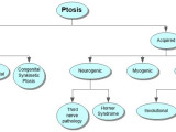 Ptosis Concept Map