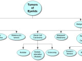 Tumors of Eyelids Concept Map