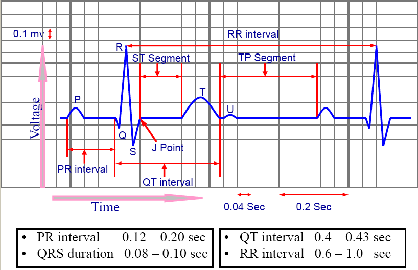 How to calculate heart rate on EKG?.