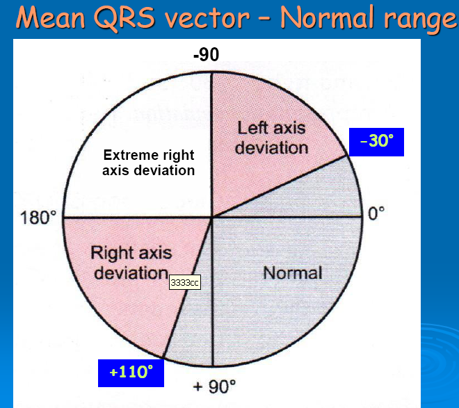 how-to-read-a-normal-ecg-electrocardiogram-hubpages