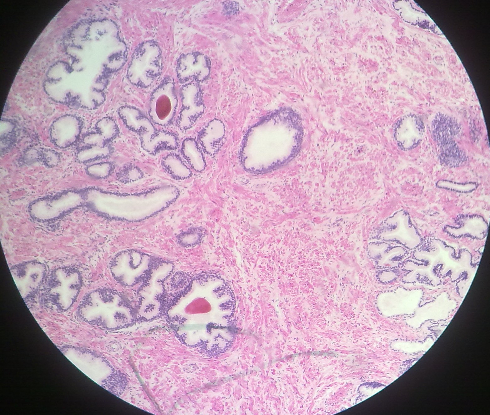 Epididymis Vas Deferens Prostate And Seminal Vesicle Howmed