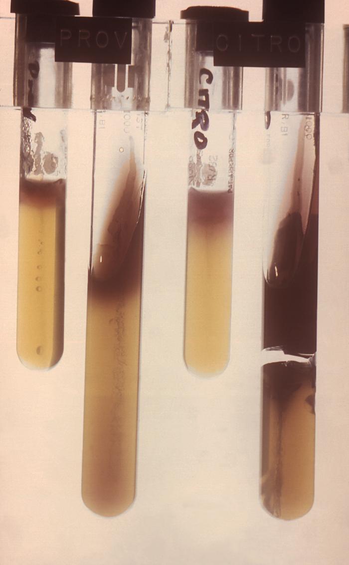 What Is Bacterial Motility In Microbiology