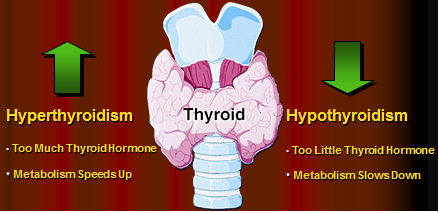 thyroid diseases