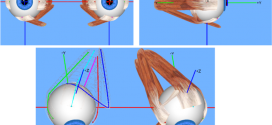 Examination of Extraocular Movements of Eye