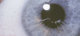 Pupillary Examination