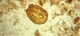Piperazine Citrate and Diethylcarbamazine -Antihelminthic Drugs