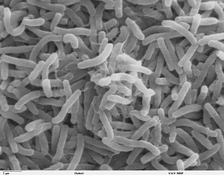 Scanning electron microscope image of Vibrio cholerae bacteria