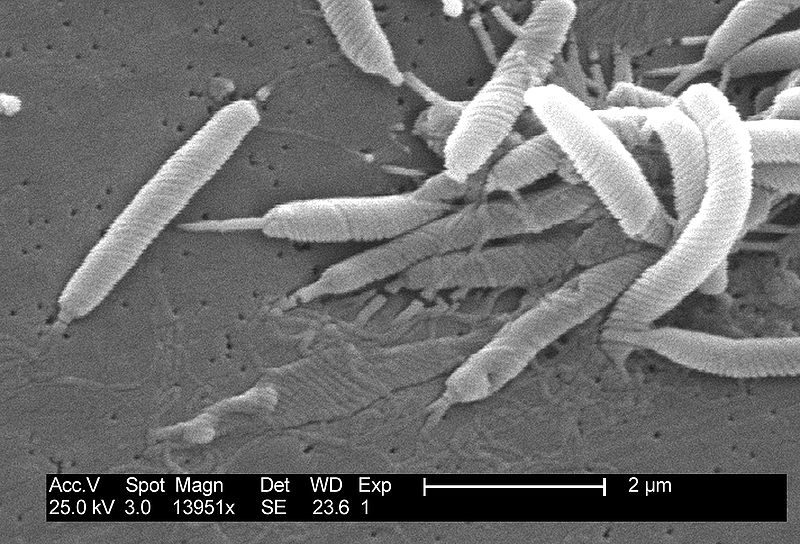 Helicobacter Pylori Howmed