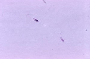 Leishmania tropica promastigote form