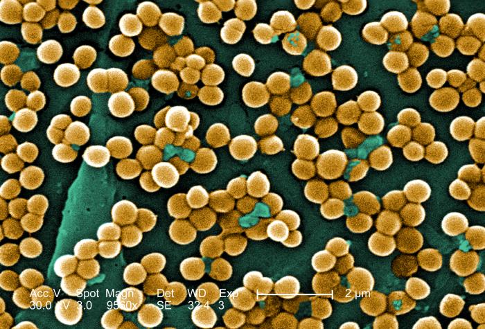 Methicillin resistant Staphylococcus aureus