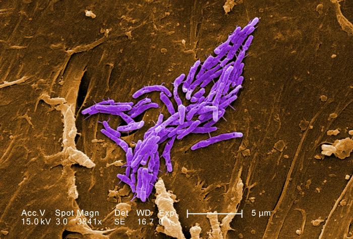 Mycobacterium fortuitum