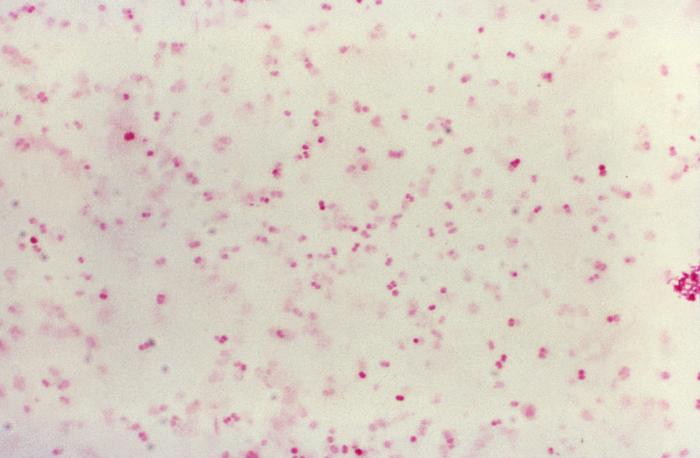 Neisseria gonorrhoeae gram stain