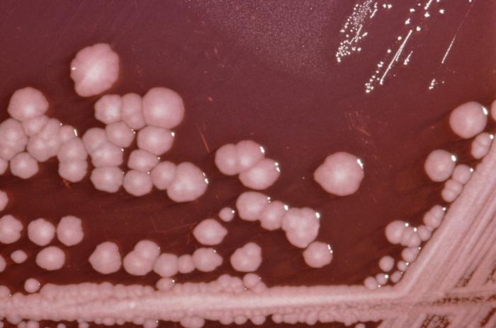 Proteus mirabilis growing on Xylose Lysine Sodium Deoxycholate agar plate