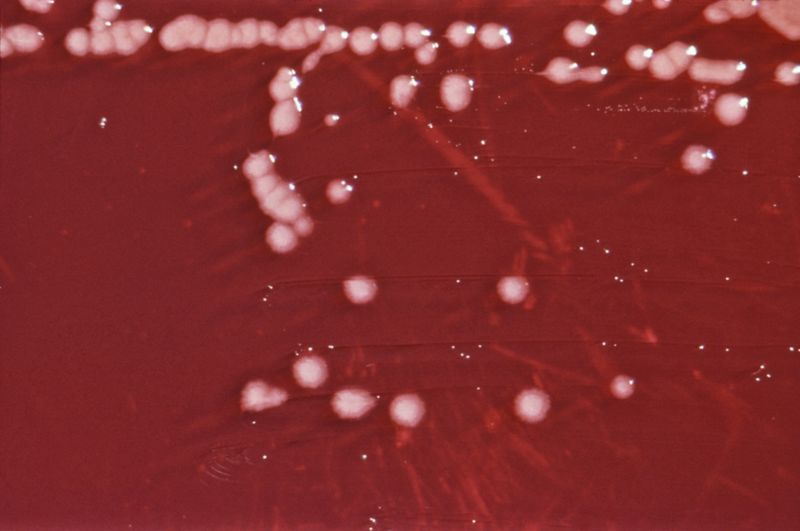 Pseudomonas Aeruginosa Howmed