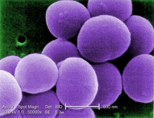 Staphylococcus aureus bacteria taken from a vancomycin intermediate resistant culture