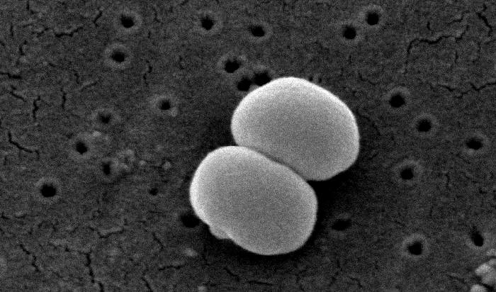 Staphylococcus epidermidis scanning electron micrograph