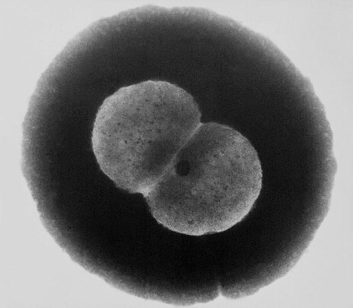 Transmission electron micrograph of Neisseria gonorrhoeae