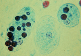 Trophozoites of Entamoeba histolytica