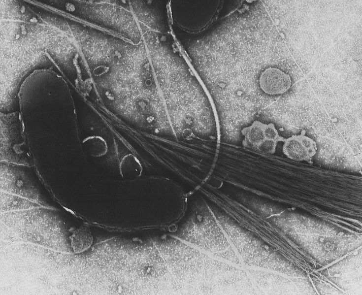 Transmission electron microsope image of Vibrio cholerae