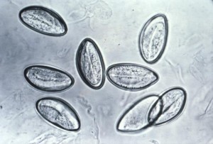 Eggs of enterobius vermicularis