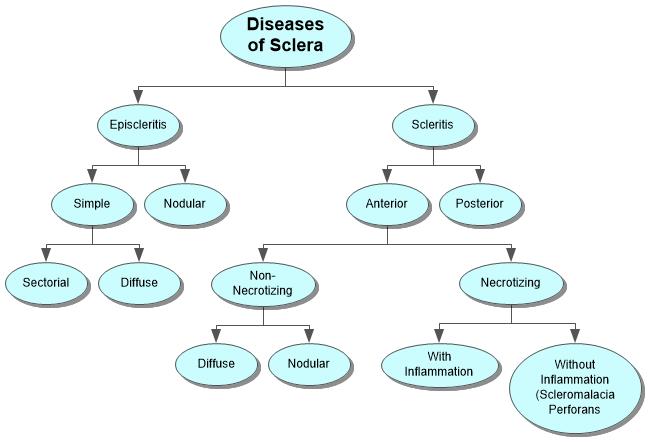 Diseases of Sclera Concept Map