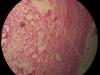 acute-inflammation-appendix-10x