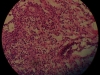 acute-inflammation-appendix-40x