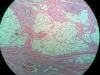 Adipose Tissue -1