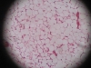 Adipose Tissue -2
