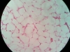 Adipose Tissue -3