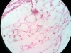 Adipose Tissue -4