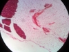 Adipose Tissue -5