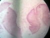 anal canal-2