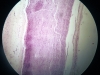 aorta-1