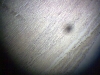 aorta-2