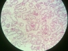 atrophy-1