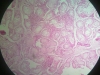 atrophy-2