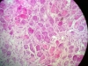 sympathetic-ganglion-2