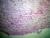 sympathetic-ganglion-3