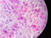 sympathetic-ganglion-4