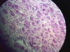 sympathetic-ganglion-5